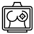 Tomosíntesis (Mamografía 3D)